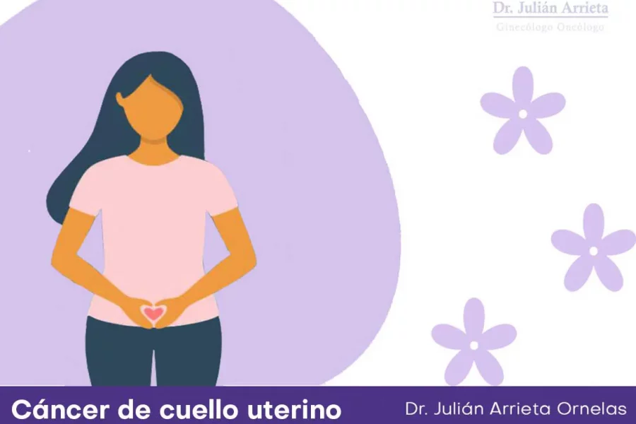 Cáncer de cuello uterino